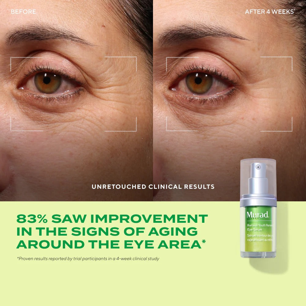 Target Eye Wrinkles | limited edition