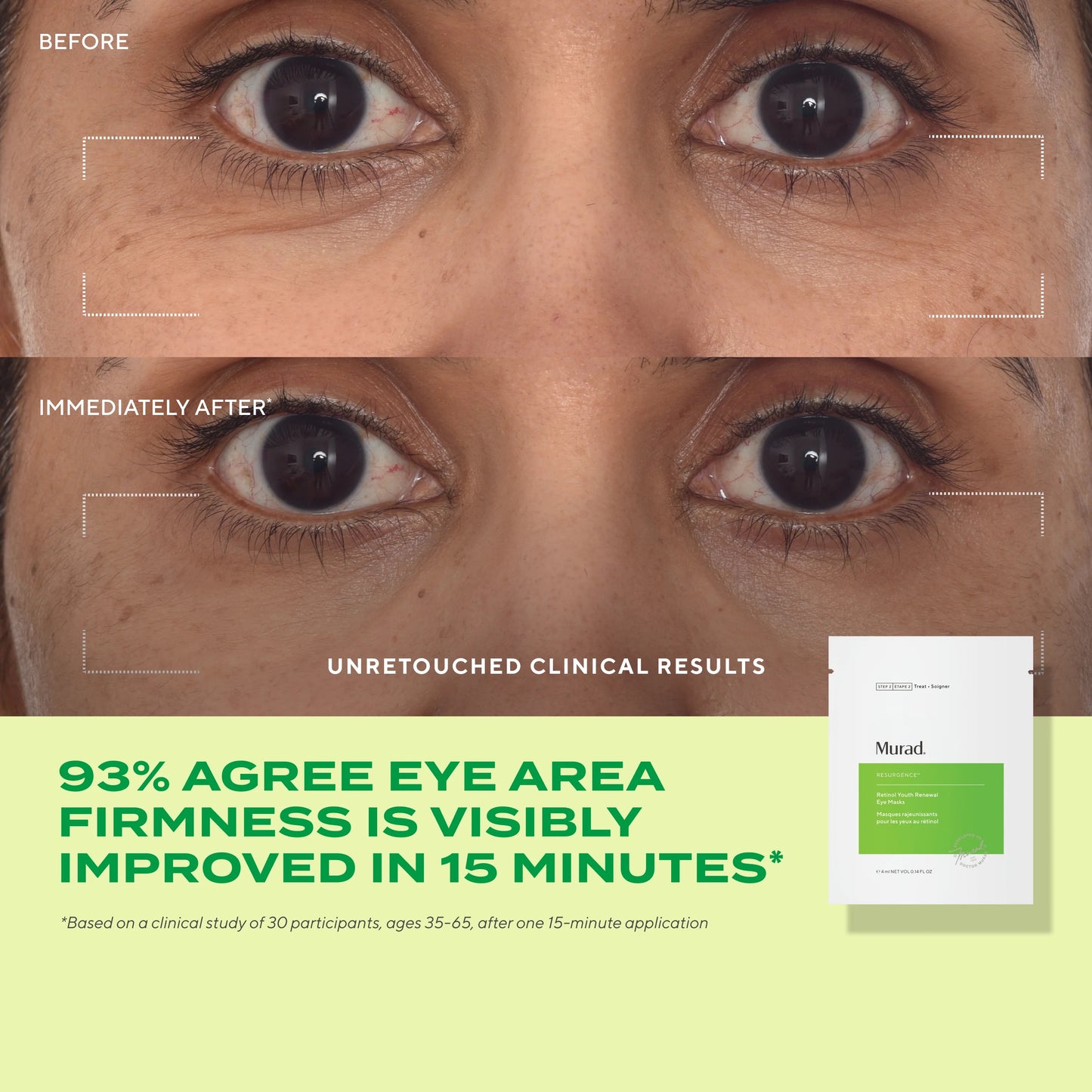 Target Eye Wrinkles | limited edition